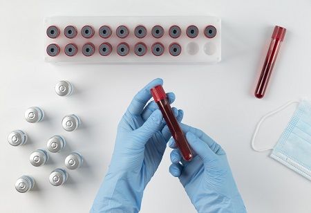 Archerfish & C2N Launch Breakthrough Alzheimer's Blood Test in Singapore